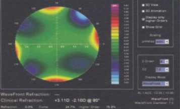 Optical Aberrations